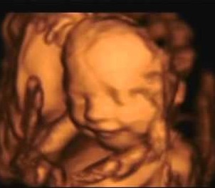 "Each child that is unborn... bears the Face of Christ." --Pope Francis